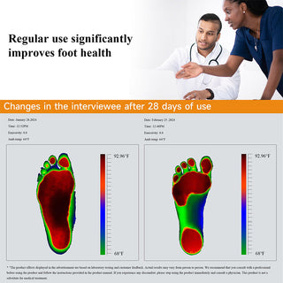 Sakerplus Foot Ice Roller Massager Tool